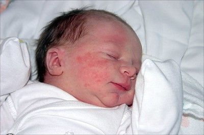 TheSecondChild